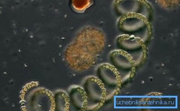 Капля под микроскопом: на фото видны простейшие водоросли и микроорганизмы