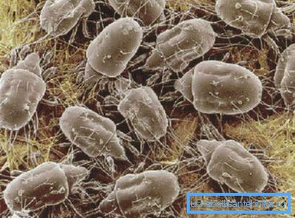 На фото - микроорганизмы, скрытые в небольшом количестве пыли
