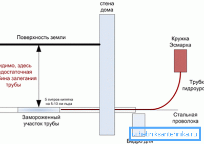 Схема использования гидроуровня и кружки Эсмарха